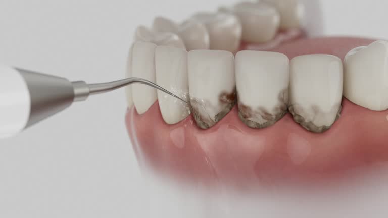 Reliable Dental Implants contractor in Oldsmar, FL by Smile Center Dentistry